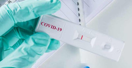 Uzman Doç. Dr. Savaşçı’dan ‘Covid-19 testinde yanıltıcı negatiflik’ uyarısı