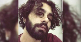 Adana'daki cinsel saldırı faili tutuklandı