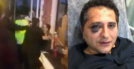 Cumhurbaşkanlığı korumalarının avukata yaptığı işkenceye takipsizlik kararı