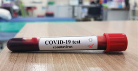 Türkiye'de son 24 saatte 87 kişi Covid-19 nedeniyle hayatını kaybetti