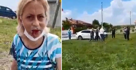 Eskişehir'de sokak hayvanlarını besleyen yurttaşa saldırı