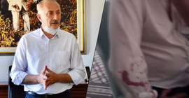 CHP’li belediye başkanına saldırıda 7 gözaltı: Saldırganlar 'tanıdık' çıktı