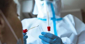 Sahte PCR testi borsası oluştu: e-Nabız’a işlemeden bakarız