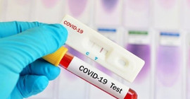 Covid-19 test kitinde ihale oyunu; Yeni kitler mutasyonu tespit etmiyor