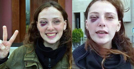 Boğaziçi öğrencisi Mısra Sapan: Polis özellikle yüzümüze vurdu