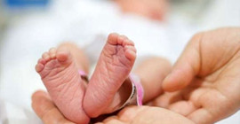 Brezilya’da bir bebek 12 santimetre kuyrukla doğdu