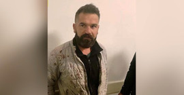 AKP’li Sayan’ın darp ettiği işçi suç duyurusunda bulundu