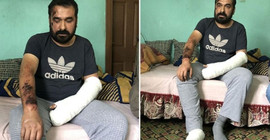 Soma faciasına da şahit olan yaralı madenci: Emekleyerek dışarı çıktım