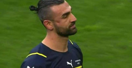 Fenerbahçe’de Serdar Dursun’un zygoma kemiği kırıldı