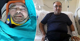 Saldırıya uğrayan Ergun Poyraz: Belediyedeki yolsuzlukları hatırlattım, akşam bu olay oldu