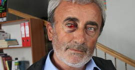 Önce işkence ettiler, daha sonra tutukladılar