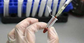 Britanya’da ortaya çıkan ‘gizemli’ virüs dünyaya yayılıyor