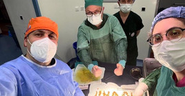 Mide şişkinliği şikayetiyle giden hastanın safra kesesinden 1250 taş çıktı