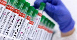 Nijerya maymun çiçeği yayılımını engellemek için vahşi hayvan eti satışını yasakladı