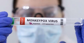 İngiltere'de 104 maymun çiçeği vakası daha tespit edildi