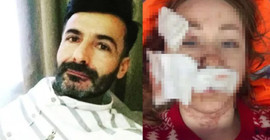 Ukraynalı eşinin yüzünü falçatayla kesen kişiye 11 yıl hapis cezası istinaftan döndü