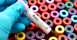 İngiltere'de kanalizasyon örneklerinde çocuk felci virüsü tespit edildi