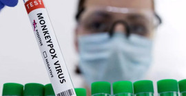 Maymun çiçeği hastalığı Panama'da da görüldü