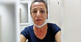 HDP'li Çetin'e köpekle işkence eden polis için ‘basit yaralama’dan dava