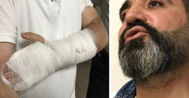 Arabuluculuk ofisinde avukata bıçaklı saldırı