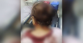 Mardin'de koruculardan köylülere saldırı: 5 yaralı