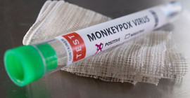 Mısır'da ilk maymun çiçeği vakası tespit edildi