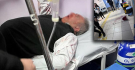 Saldırıya uğrayan aile hekimi yaralandı
