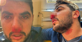 Sağlıkta şiddet durmuyor: İstanbul'da hasta yakını hemşireye yumruklu saldırıda bulundu
