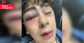 Lice'de çocuğa polis işkencesi: 'Silah vardı ama kullanmadık, taş gelmiş olabilir'