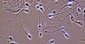 Hollanda yargısından sperm donörüne yasak: 550'den fazla çocuğun babası olmuş