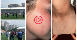 İzmir'de sahaya giren erkek taraftarlar kadın futbolculara saldırdı