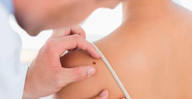 HPV kaynaklı cilt kanseri tedavisinde umut veren aşı