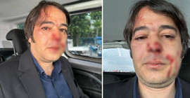İBB İmar Müdürü Ramazan Gülten'e saldıran sanık hakkında 10 yıl 9 ay hapis talebi