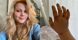 Evli olduğu erkek tarafından bıçaklanan Merve Veziroğlu'ndan iyi haber: Mucizevi şekilde hayatta kaldım