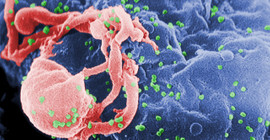 HIV tedavisinde 'kök hücre' umudu