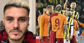 Galatasaray, Icardi'nin son halini paylaştı, Fenerbahçe'den yanıt geldi