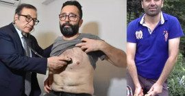 Türkiye'de ilk: Nakil kalbe 25 yıl sonra baypas ameliyatı yapıldı