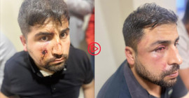 AKP’li belediye İmrahor mahallesinde yıkım kararı aldı, mahalleli ters kelepçeyle gözaltına alındı