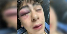 Lice’de çocuğa işkence davasında polislere sekizer yıl ceza