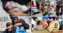 Gazze'deki yabancı doktorlar, İsrail'in şarapnel etkili bombalarının çocuklara etkisini anlattı
