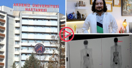Akıllı ilaçlar, akciğer kanserinde ömrü 22 ay uzattı