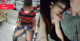 Hakkını istediği için işkence gören Urfalı işçi adalet arıyor: 'Hayatım altüst oldu'