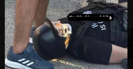 Eskişehir'de çelik yelekli ve maskeli saldırgan beş kişiyi bıçak ve baltayla yaraladı