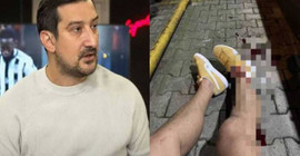 Serhat Akın’a silahlı saldırının iddianamesi hazırlandı