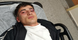 Silvan'da polis şiddeti: Havaya ateş açtı, iki kişiye gözaltı