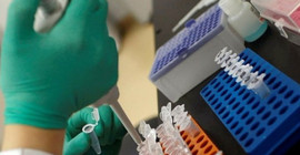Kanseri başlangıcında tespit edebilecek deri implantı geliştirildi