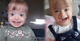 Lösemi tedavisi gören down sendromlu bebek ilik nakli bekliyor