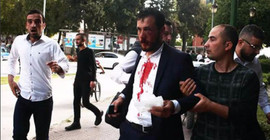 Furkan Vakfı üyelerine sert polis müdahalesi