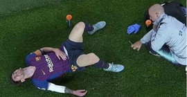 Messi'nin sağ kolu çatladı