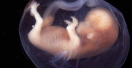 'Üç ebeveynli' 3. çocuk Yunanistan'da doğacak